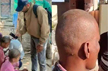 Sudden hair loss, baldness in Maharashtra villages sparks panic